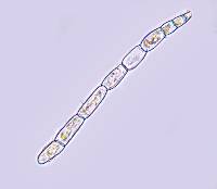 Streblotrichum convolutum image